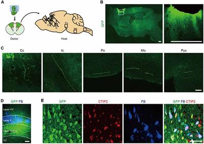 L1CAM Is a Marker for Enriching Corticospinal Motor Neurons in the Developing Brain